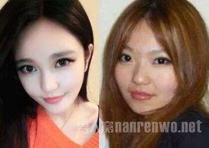 爆料小猪整容视频播放大全,视频播放大全大起底